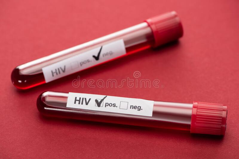 Focus Of Negative And Positive Hiv Stock Image