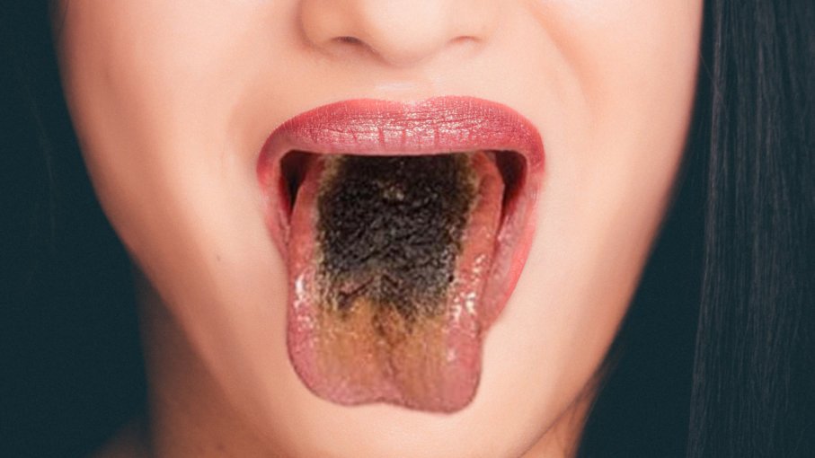 Healthy Discuss: What Your Tongue Says About Your Health