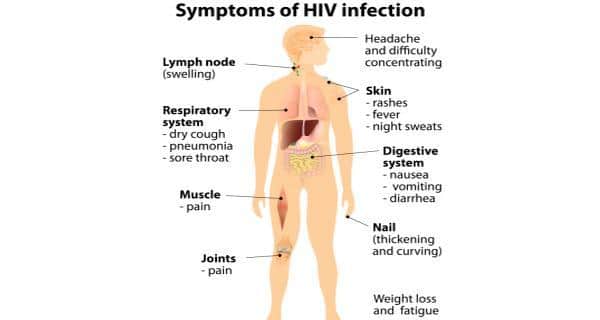 Hiv Symptoms