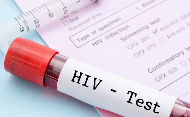 TESTE DE HIV PODE SER ADQUIRIDO EM FARM?CIAS